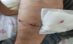 Şanlıurfa’da Sabah Sporu Kabusa Döndü: İki Kişiye Köpek Saldırısı!