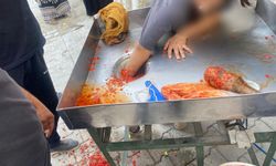 Şanlıurfa’da Genç Kız Elini Salça Makinesi Kaptırdı