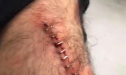 Karaköprü'de Öğretmene Jiletli Saldırı