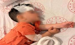 Halfeti’de Dehşet Anları! 1,5 Yaşındaki Çocuğa Sokak Köpeği Saldırdı