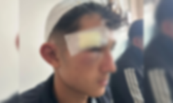 Şanlıurfa’da Okul Dışında Bıçaklı Saldırı İddiası: 2 Öğrenci Yaralı