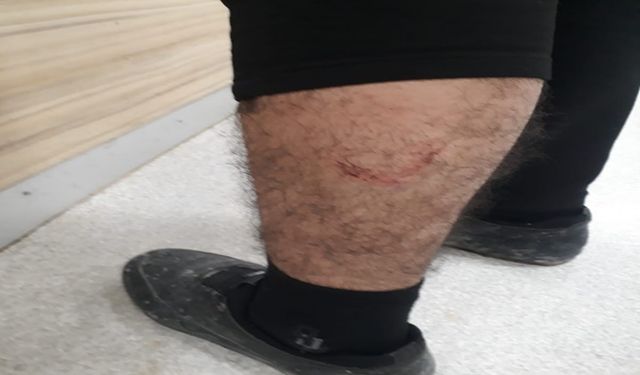 Şanlıurfa’da Yine Köpek Saldırısı!