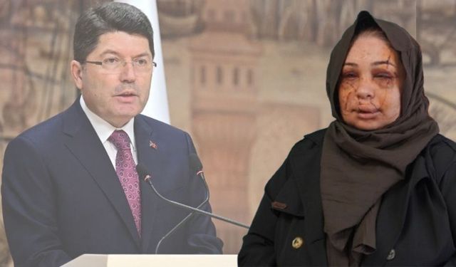 Şanlıurfalı Eşine Şiddet Uygulayan Koruma Tutuklandı