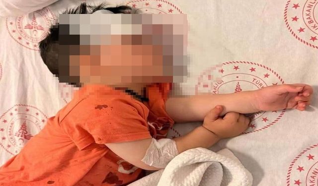 Halfeti'deki Köpek Saldırısında Yeni Gelişme! İçişleri İnceleme Başlattı