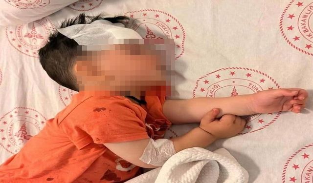 Halfeti’de Dehşet Anları! 1,5 Yaşındaki Çocuğa Sokak Köpeği Saldırdı