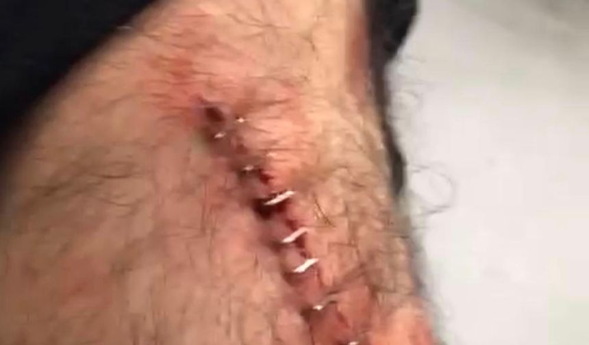 Karaköprü'de Öğretmene Jiletli Saldırı