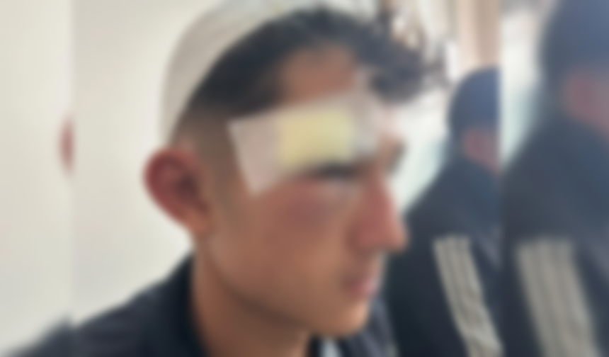 Şanlıurfa’da Okul Dışında Bıçaklı Saldırı İddiası: 2 Öğrenci Yaralı